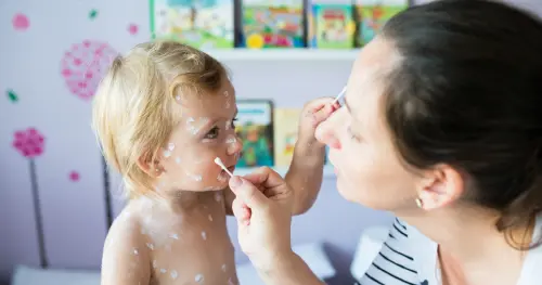 Головне про вітрянку