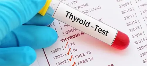 Расшифровка результатов: повышенный ТТГ и его причины