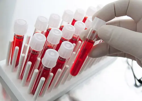 аналізи при клімаксі