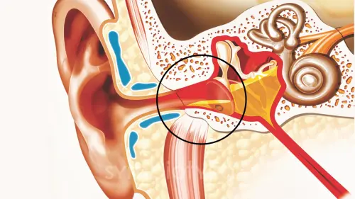 Чому виникає рідина у середньому вусі