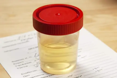 Якого кольору має бути сеча в нормі у здорової людини