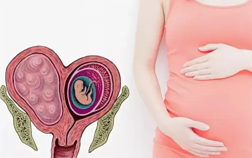 Вагітність і міома матки