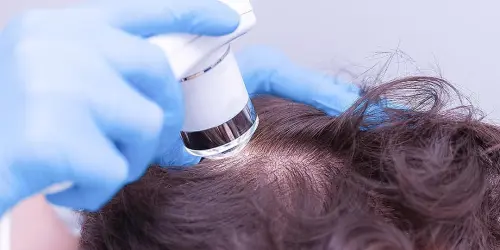 Трихоскопия