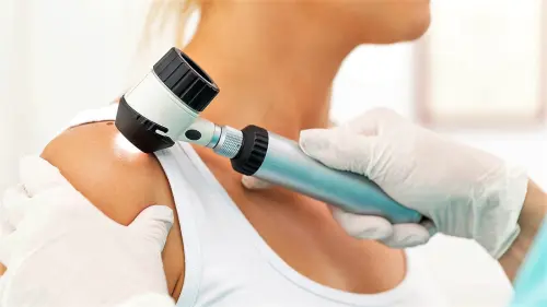 Лікування псоріазу в клініці