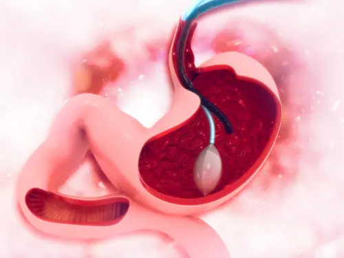 Як лікують виразку шлунка