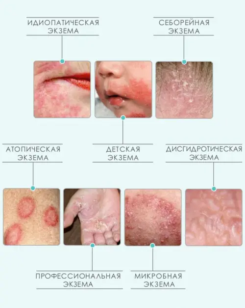 Види екземи