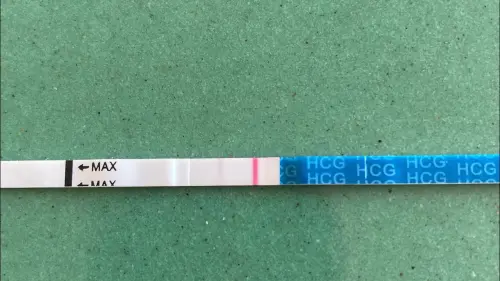 ХГЛ після ЕКЗ