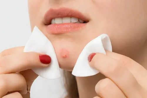 Мазі від фурункулів і антибіотики при фурункулі