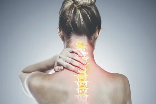 Остеохондроз шийного відділу хребта