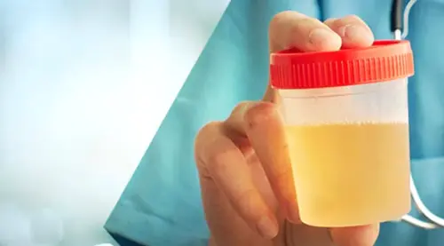 Чому сеча стала каламутною: осад, пластівці та пінистість