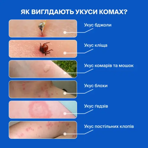 Основные виды насекомых-аллергенов