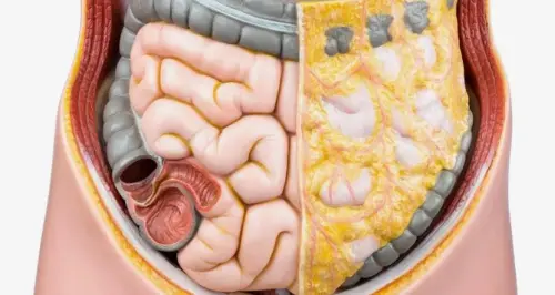 Опасен ли висцеральный жир и реальные риски для здоровья