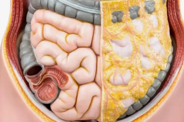 Висцеральный жир: как избавиться безопасно и стабильно