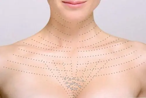 комплексный уход за зоной декольте