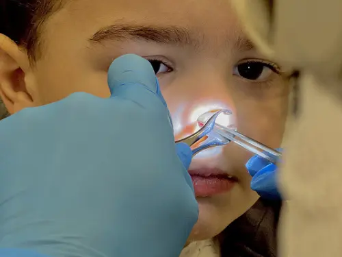 Что такое удаление инородного тела из носа