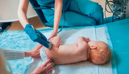 УЗИ тазобедренных суставов у новорожденных