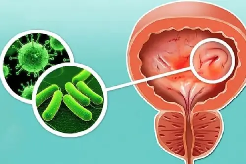разновидности инфекций мочевыводящих путей