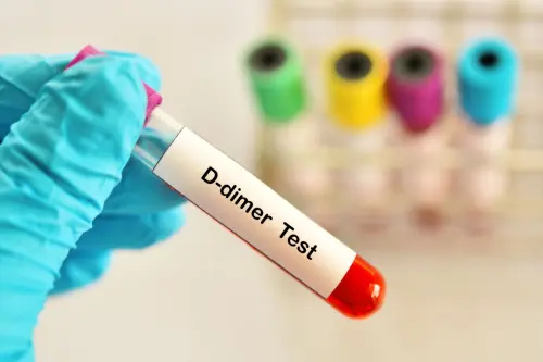 Показання до проведення дослідження системи гемостазу