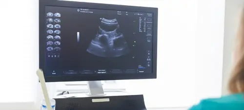 Получение и интерпретация результатов