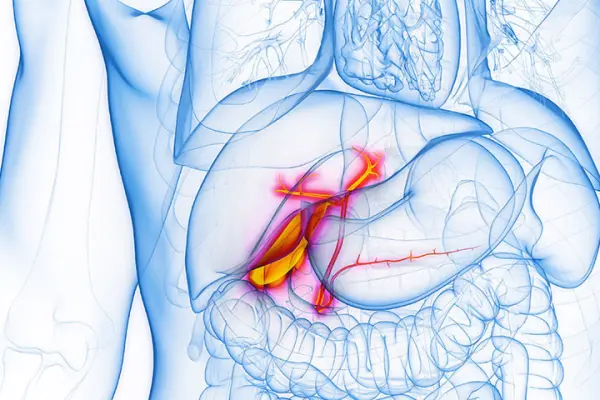 Холецистит: симптомы и когда необходима операция