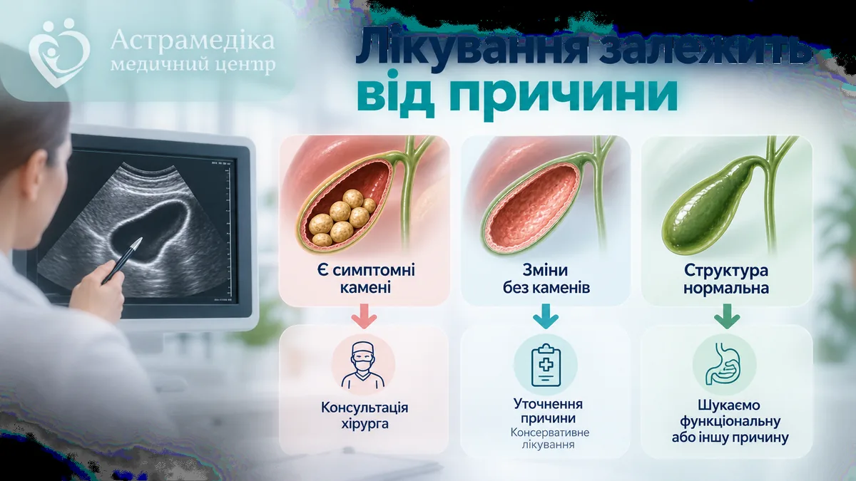 Тактика лікування холециститу залежно від причини та результатів обстеження