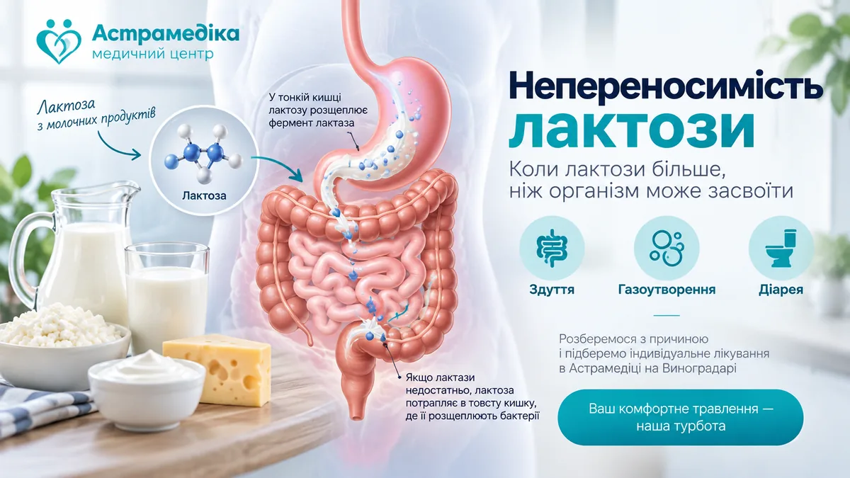 Непереносимість лактози та її основні симптоми