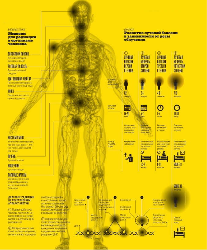Как человек ощущает радиацию: симптомы лучевой болезни